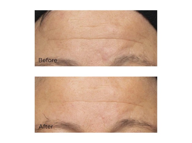 Perricone MD Cold Plasma Plus+ The Intensive...
