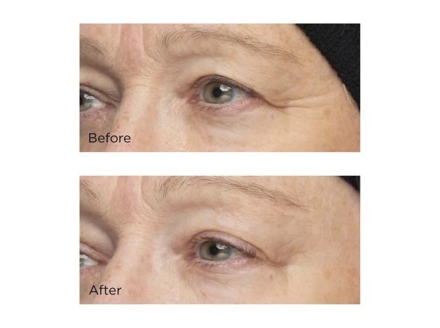 Perricone MD Cold Plasma Plus+ The Intensive...