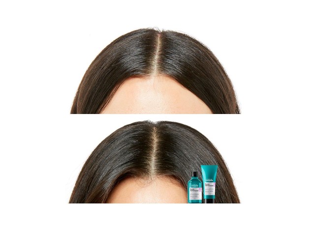 L'Oréal Scalp Advanced Anti-Discomfort...