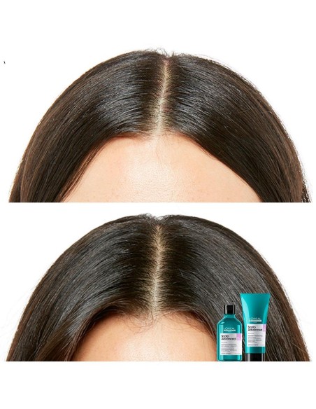 L'Oréal Professionnel Scalp Advanced Shampoo Sensitive 500Ml