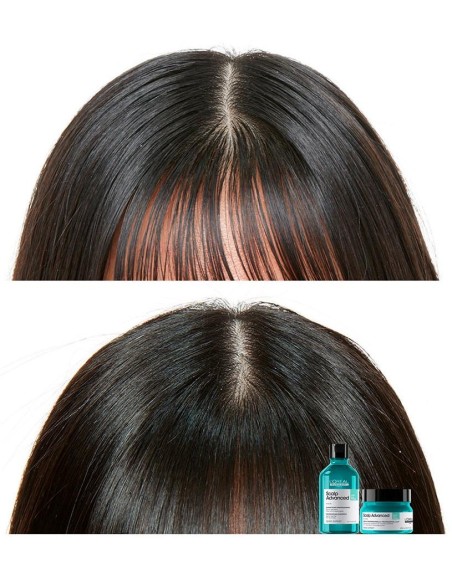 L'Oréal Scalp Advanced Anti-Oiliness 2In1 Deep Purifier Clay 250Ml