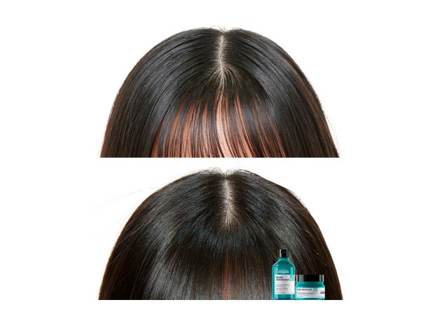 L'Oréal Scalp Advanced Anti-Oiliness...