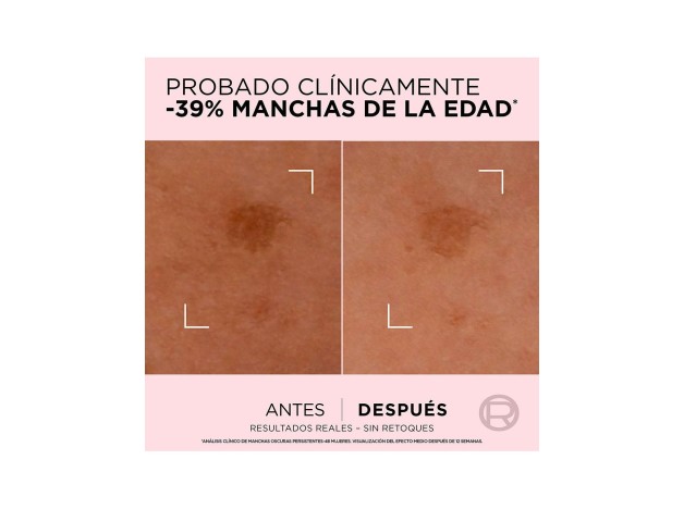 L'Oréal Age Perfect Serum Corrector 30Ml