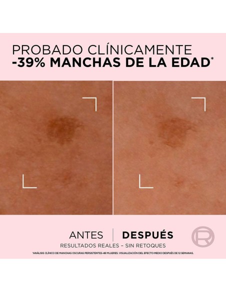 L'Oréal Age Perfect Serum Corrector 30Ml