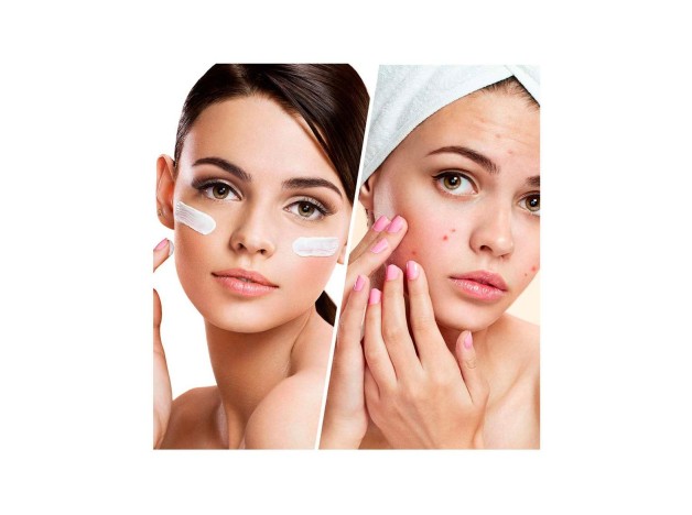 Blemish Control Clear Complexion Facial...