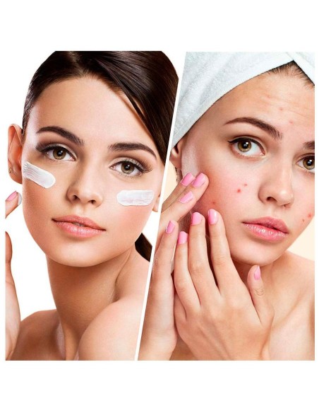 Blemish Control Clear Complexion Facial Moisturizer Lotion 50 Ml