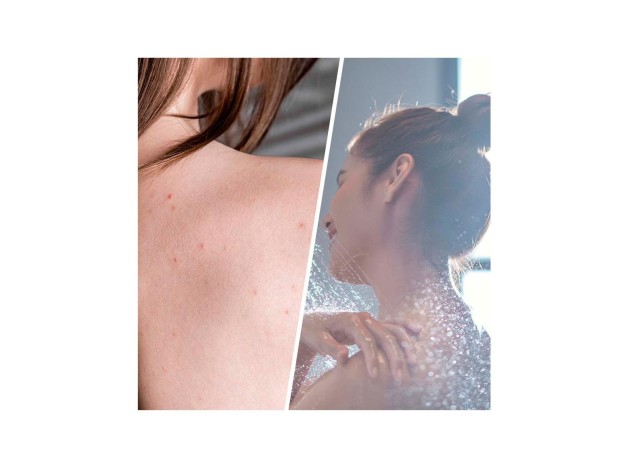 Biovène Salicylic Blemish Scrub Detoxifying 250Ml