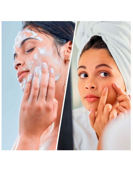 Salicyclic Super Cleanser Face %26 Body Blackhead + Breakout 200 Ml