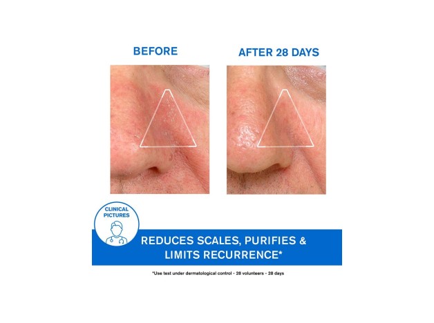 Ds Emulsion Corporal-Capilar Piel Escamada 40Ml.