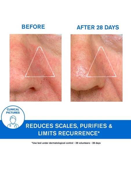 Ds Emulsion Corporal-Capilar Piel Escamada 40Ml.