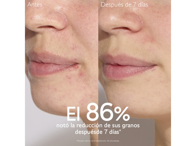 Caudalie Vinopure Serum 30 ml