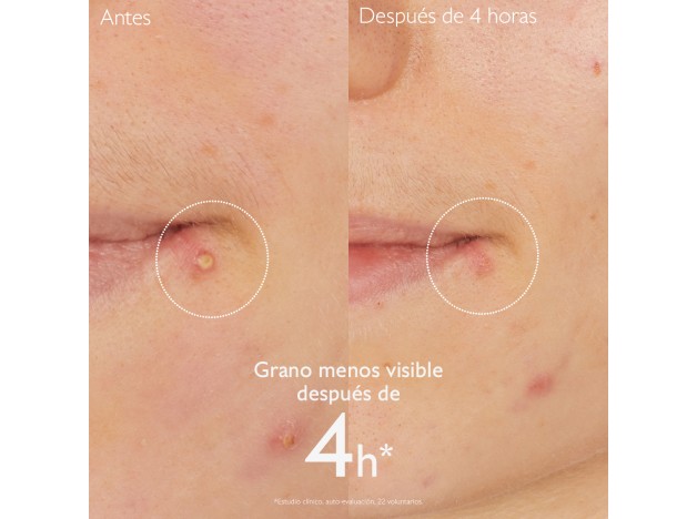 Caudalie Vinopure Stop Granos 15 ml