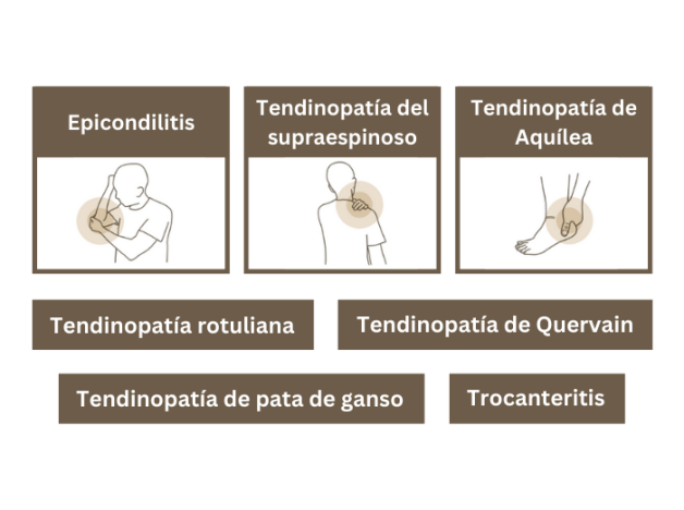 Tendisulfur Forte 28 Sobres