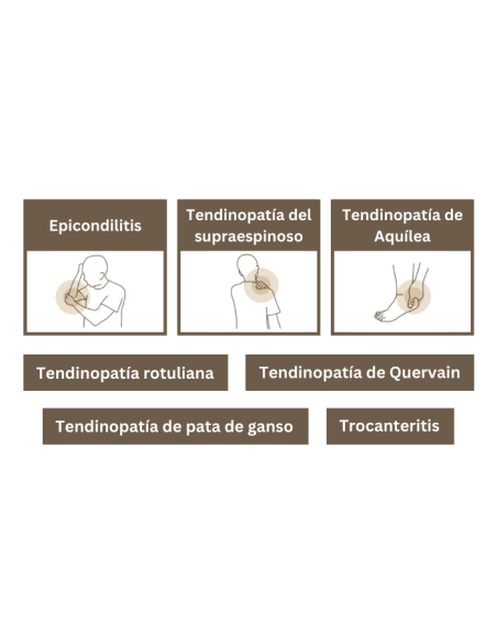 Tendisulfur Forte 2x28 Sobres ¡Duplo!