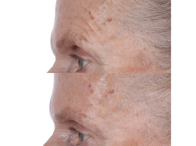Perricone High Potency Face Finishing & Firming...
