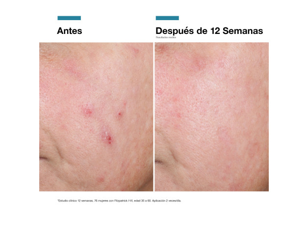 Skinceuticals Advanced Rgn-6 Crema Regenadora...