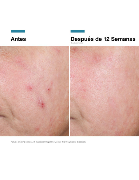 Skinceuticals Advanced Rgn-6 Crema Regenadora Post-Procedimientos 50 ml