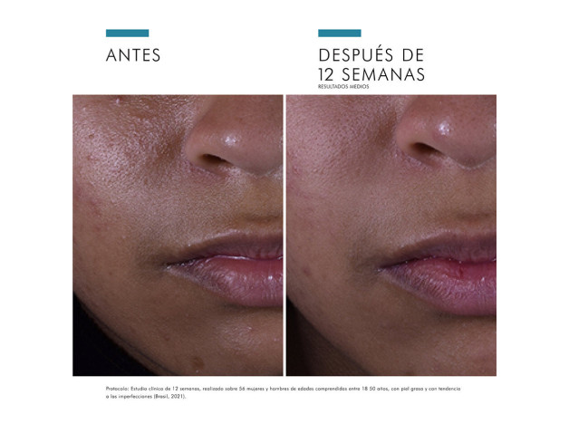 Skinceuticals Silymarin Cf Antiox Alta Potencia...