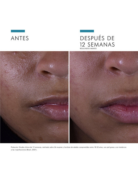 Skinceuticals Silymarin Cf Antiox Alta Potencia 30 ml