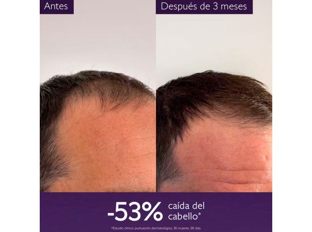 Caudalie Serum Capilar Anticaída 50 ml
