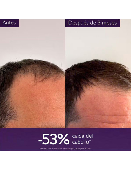 Caudalie Serum Capilar Anticaída 50 ml