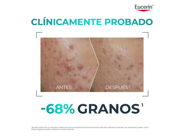 Eucerin Dermopure Clinical Probiom8