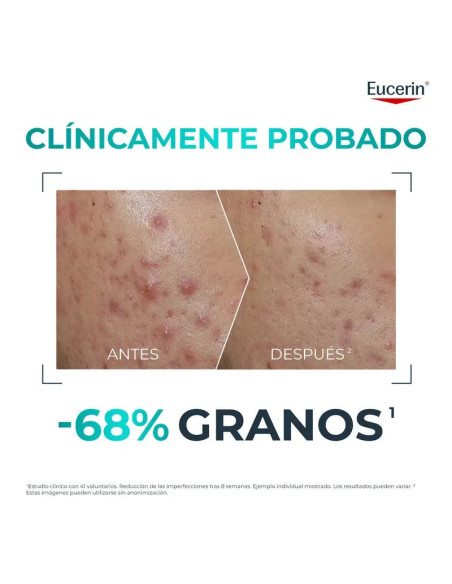 Eucerin Dermopure Clinical Probiom8