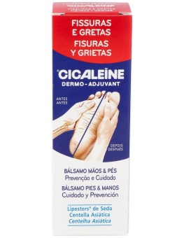 Akileine Cicaleine Fisuras...
