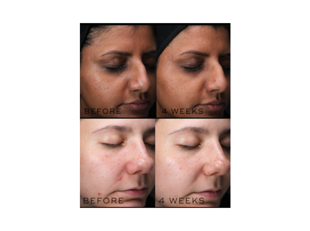 Medik8 Clarity Peptides 30 ml