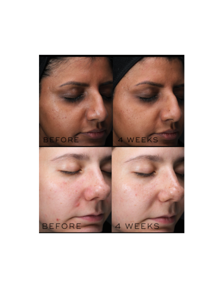 Medik8 Clarity Peptides 30 ml