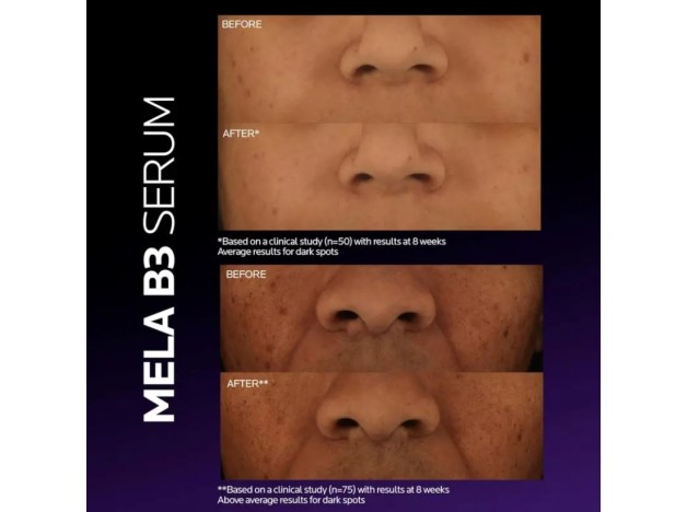 La Roche Posay Mela B3 Serum Antimanchas 30 ml