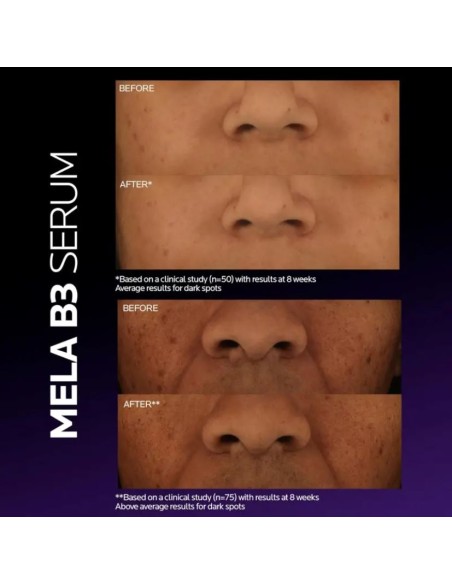 La Roche Posay Mela B3 Serum Antimanchas 30 ml