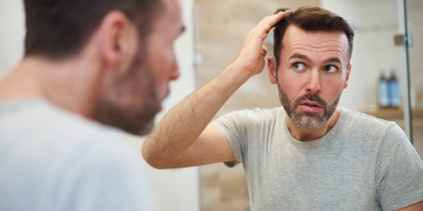 Caída del pelo en hombres: Tratamientos y consejos