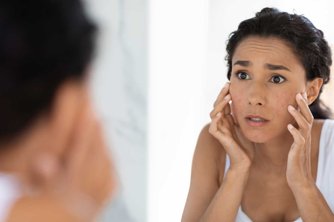 Cómo tratar el eczema y la dermatitis